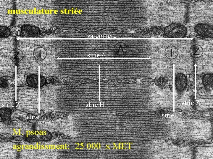 musculature striée sarcomère strie A strie Z strie H strie I M. psoas agrandissment: