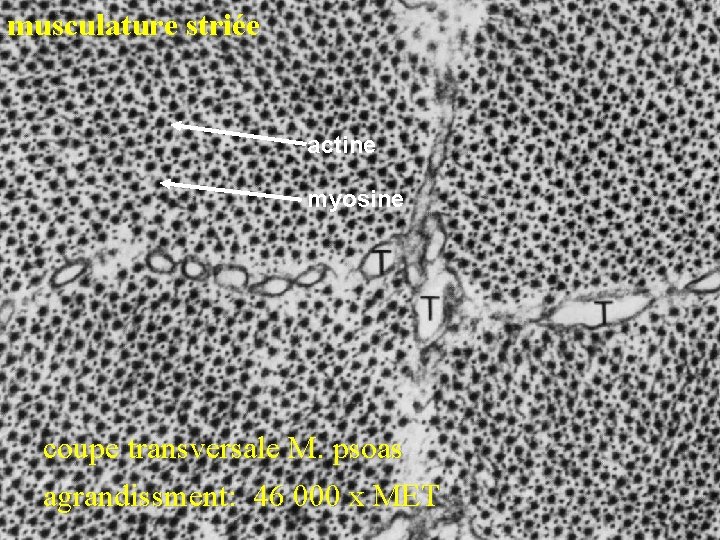 musculature striée actine myosine coupe transversale M. psoas agrandissment: 46 000 x MET 