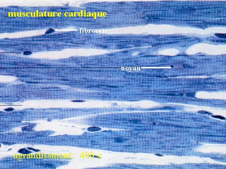 musculature cardiaque fibrocyte noyau agrandissment: 400 x 