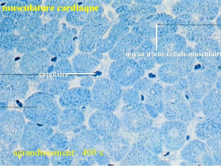 musculature cardiaque noyau d’une cellule musculaire capillaire agrandissement: 400 x 