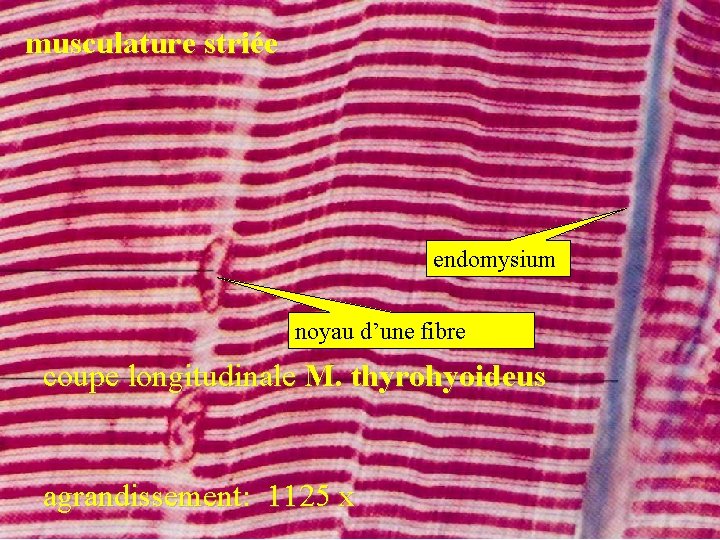 musculature striée endomysium noyau d’une fibre coupe longitudinale M. thyrohyoideus agrandissement: 1125 x 