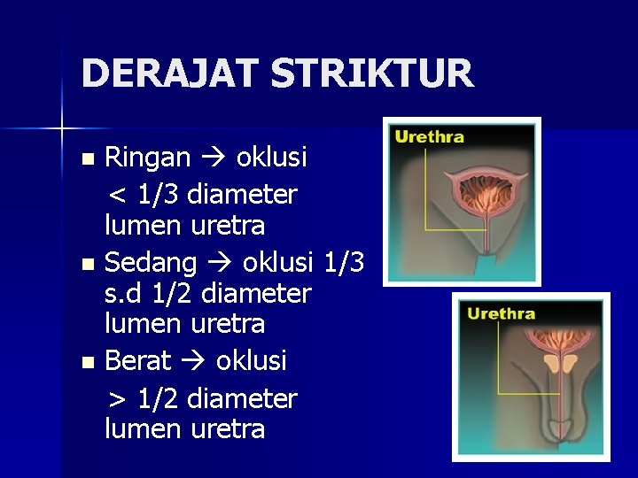 DERAJAT STRIKTUR Ringan oklusi < 1/3 diameter lumen uretra n Sedang oklusi 1/3 s.