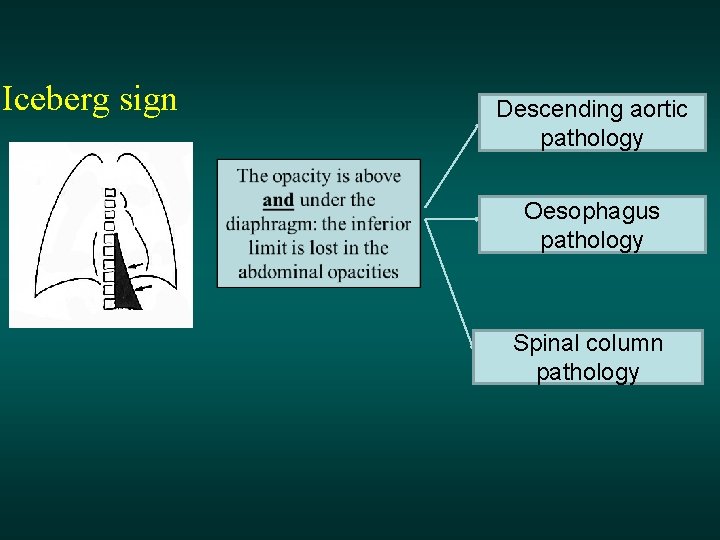 Iceberg sign Descending aortic pathology Oesophagus pathology Spinal column pathology 