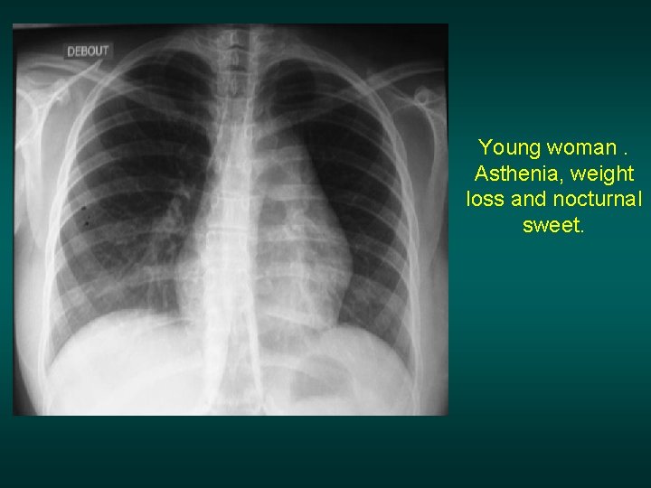 Young woman. Asthenia, weight loss and nocturnal sweet. 