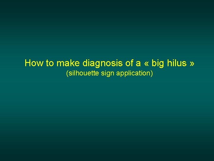 How to make diagnosis of a « big hilus » (silhouette sign application) 