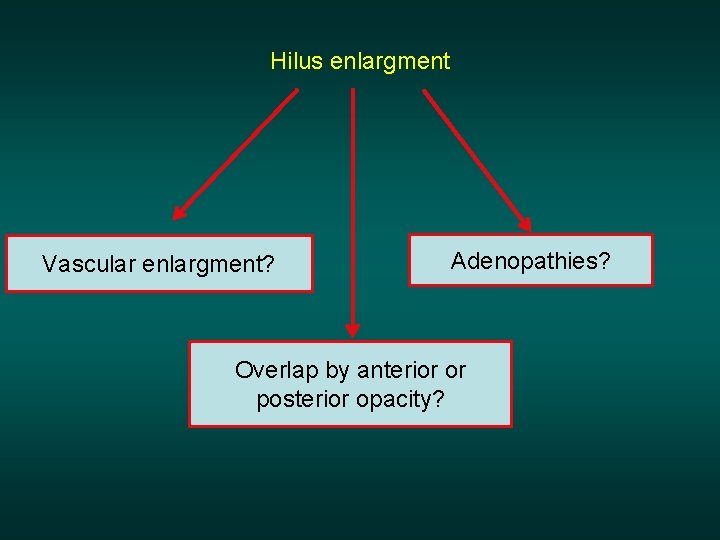 Hilus enlargment Vascular enlargment? Adenopathies? Overlap by anterior or posterior opacity? 
