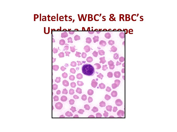 Platelets, WBC’s & RBC’s Under a Microscope 
