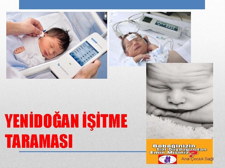 YENİDOĞAN İŞİTME TARAMASI 