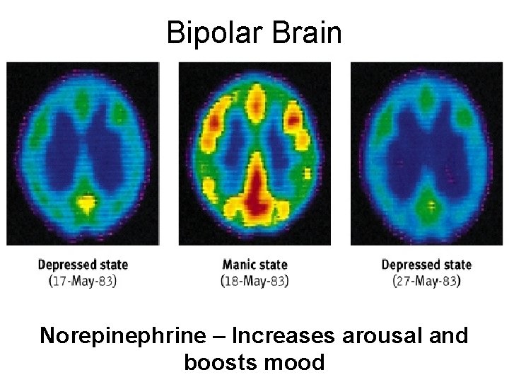 Bipolar Brain Norepinephrine – Increases arousal and boosts mood 