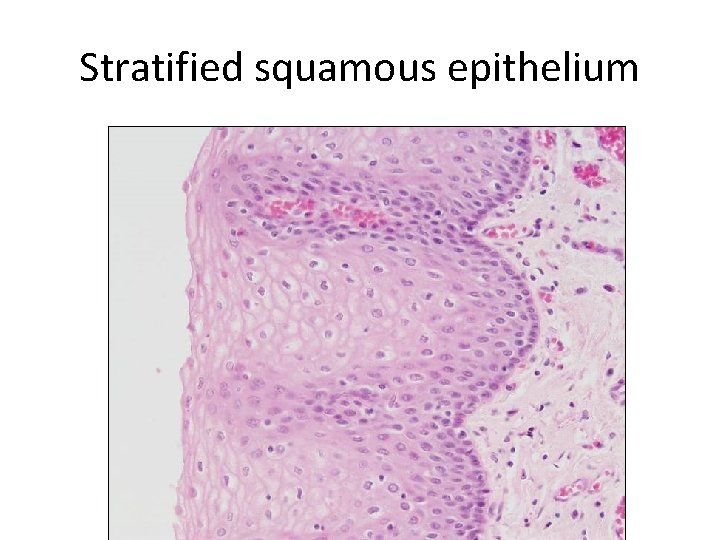Stratified squamous epithelium 