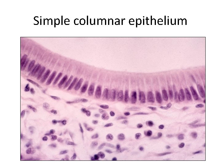Simple columnar epithelium 