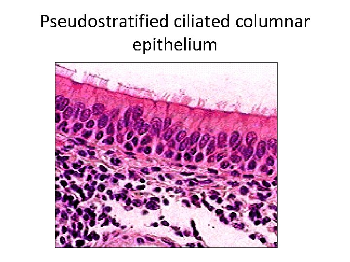 Pseudostratified ciliated columnar epithelium 