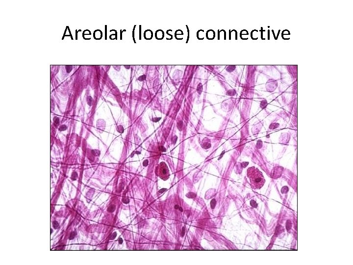 Areolar (loose) connective 