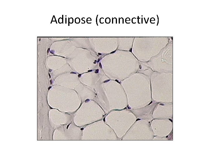 Adipose (connective) 