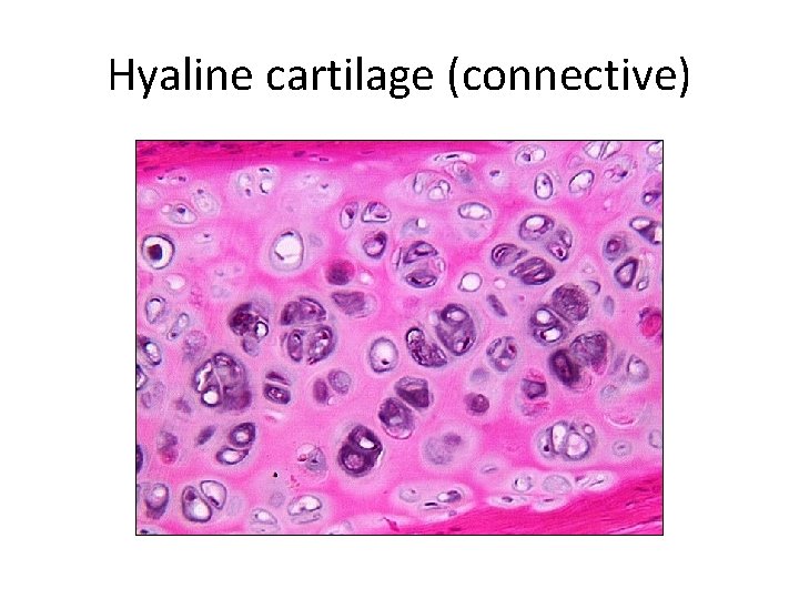 Hyaline cartilage (connective) 