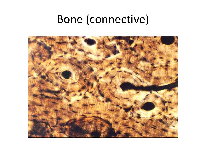 Bone (connective) 