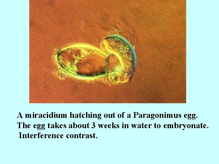 A miracidium hatching out of a Paragonimus egg. The egg takes about 3 weeks