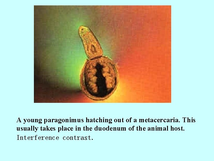 A young paragonimus hatching out of a metacercaria. This usually takes place in the