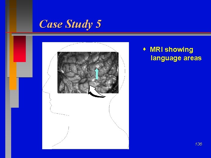 Case Study 5 MRI showing language areas 136 