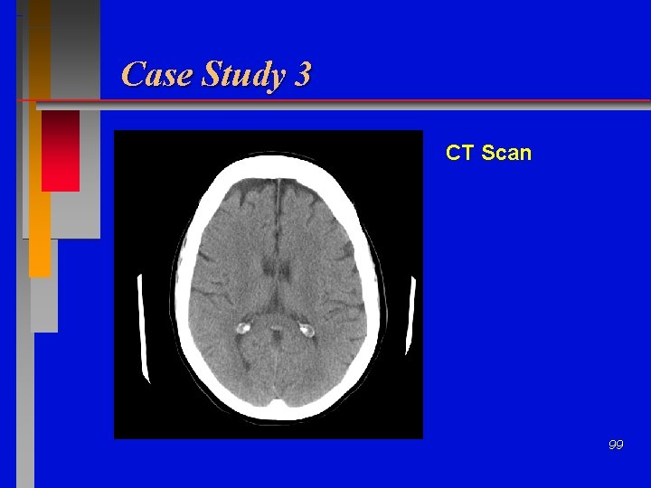 Case Study 3 CT Scan 99 