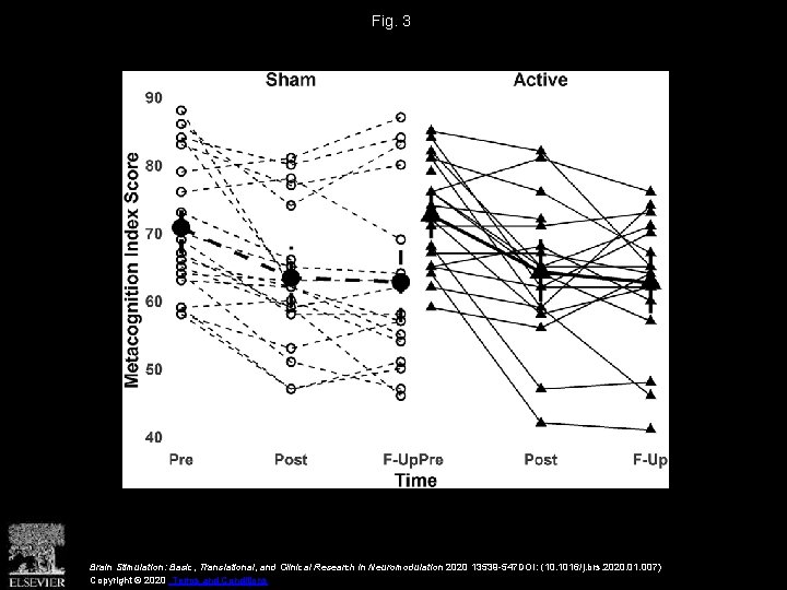 Fig. 3 Brain Stimulation: Basic, Translational, and Clinical Research in Neuromodulation 2020 13539 -547