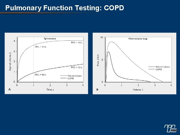 Pulmonary Function Testing: COPD 