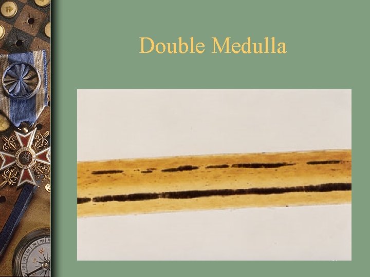 Double Medulla 17 