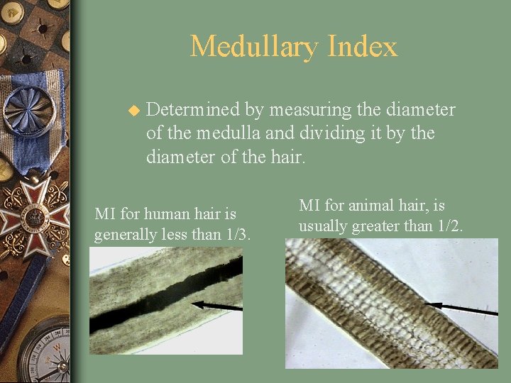 Medullary Index u Determined by measuring the diameter of the medulla and dividing it