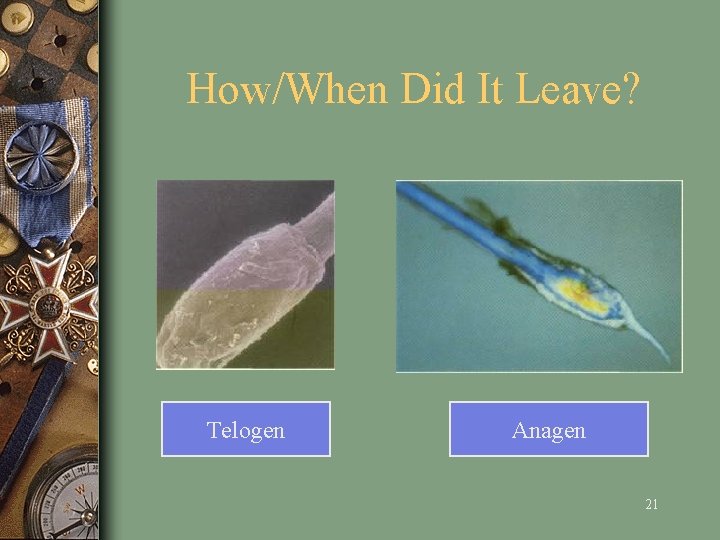 How/When Did It Leave? Telogen Anagen 21 