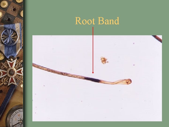 Root Band 25 