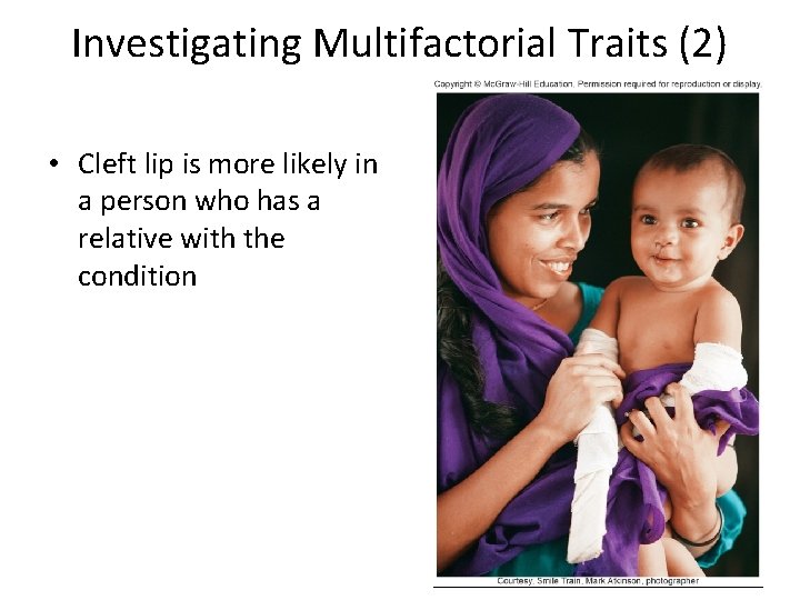 Investigating Multifactorial Traits (2) • Cleft lip is more likely in a person who