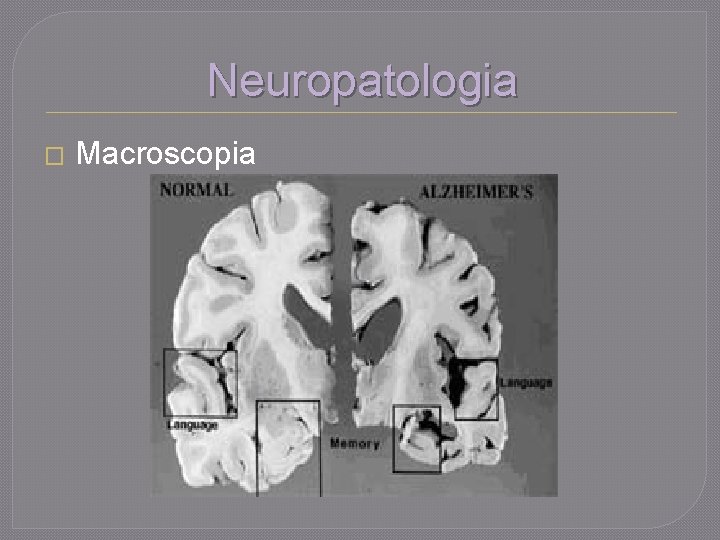 Neuropatologia � Macroscopia 