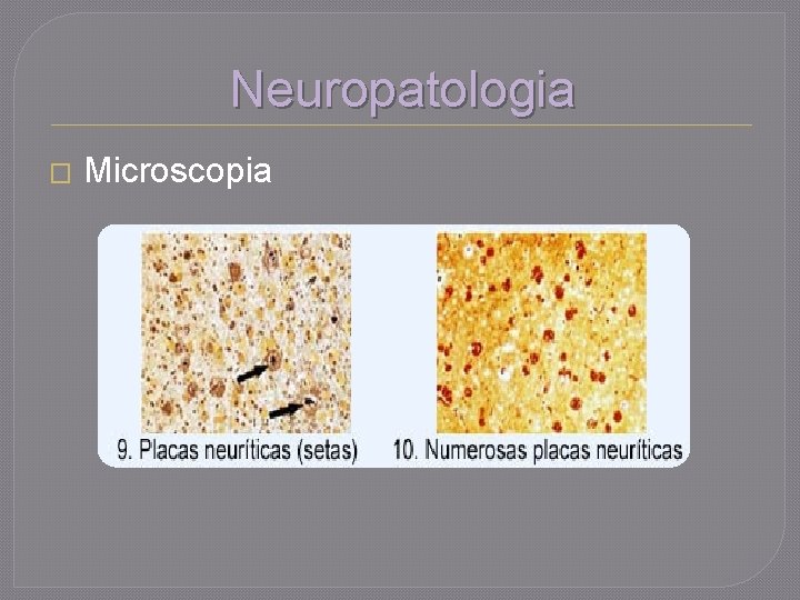 Neuropatologia � Microscopia 