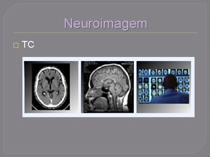 Neuroimagem � TC 
