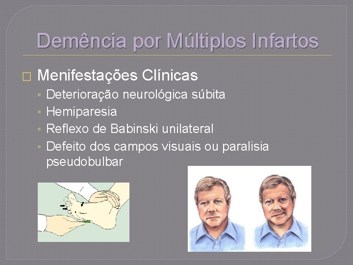 Demência por Múltiplos Infartos � Menifestações Clínicas • • Deterioração neurológica súbita Hemiparesia Reflexo