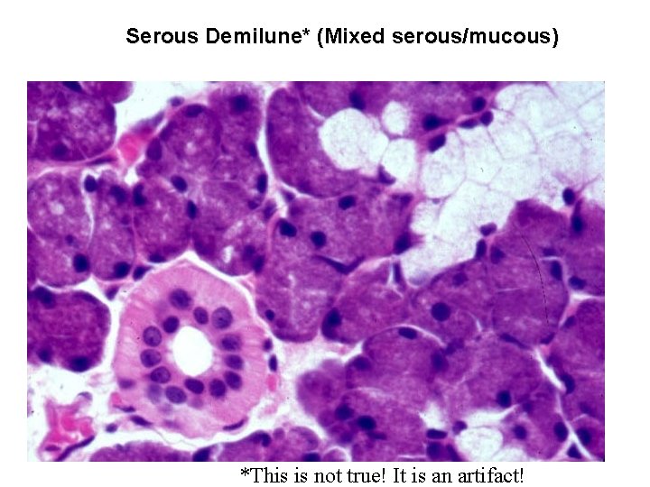 Serous Demilune* (Mixed serous/mucous) *This is not true! It is an artifact! 