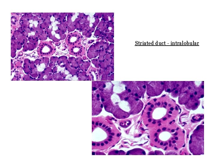 Striated duct - intralobular 