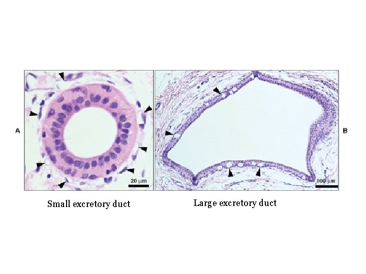 Small excretory duct Large excretory duct 