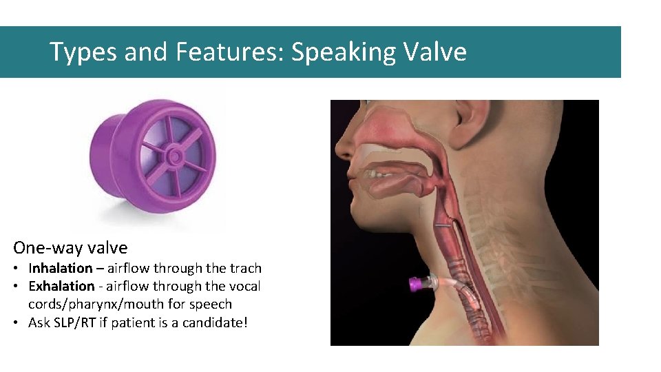 Types and Features: Speaking Valve One-way valve • Inhalation – airflow through the trach Types and Features: Speaking Valve One-way valve • Inhalation – airflow through the trach
