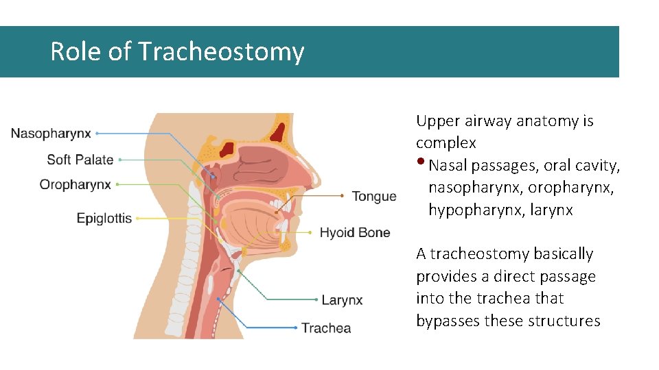 Role of Tracheostomy Upper airway anatomy is complex • Nasal passages, oral cavity, nasopharynx, Role of Tracheostomy Upper airway anatomy is complex • Nasal passages, oral cavity, nasopharynx,