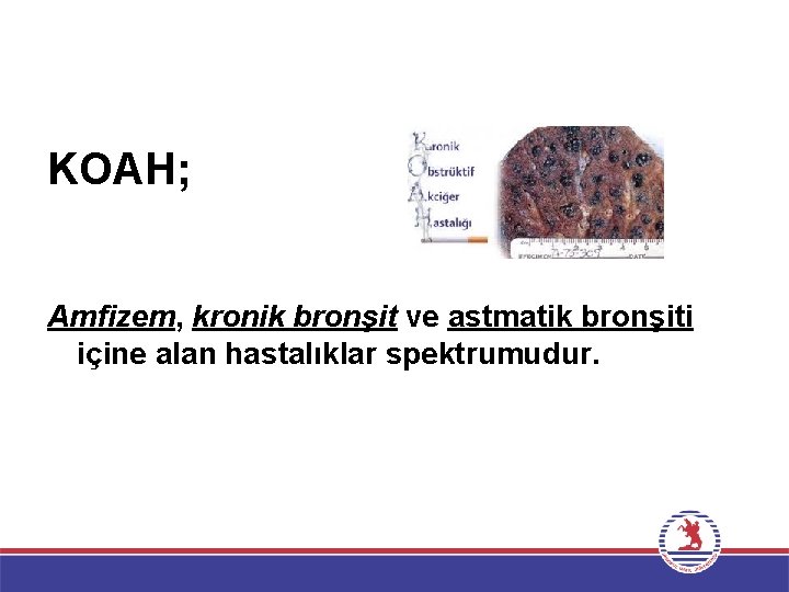 KOAH; Amfizem, kronik bronşit ve astmatik bronşiti içine alan hastalıklar spektrumudur. 