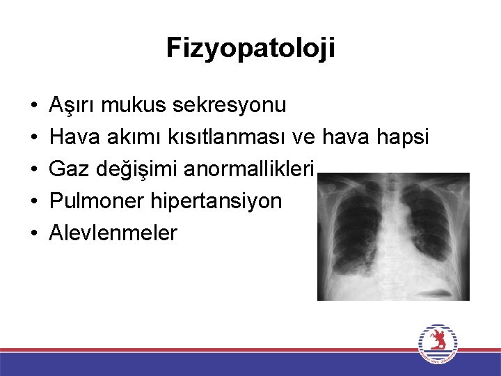 Fizyopatoloji • • • Aşırı mukus sekresyonu Hava akımı kısıtlanması ve hava hapsi Gaz