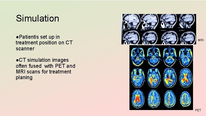 Simulation ●Patientis set up in treatment position on CT scanner MRI ●CT simulation images