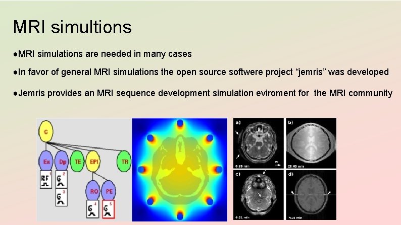 MRI simultions ●MRI simulations are needed in many cases ●In favor of general MRI