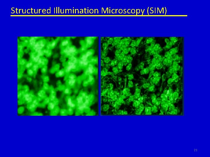 Structured Illumination Microscopy (SIM) 21 