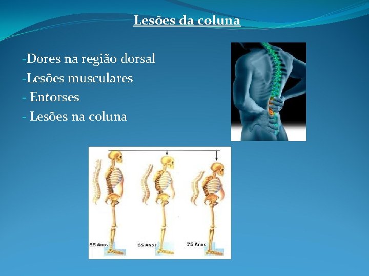 Lesões da coluna -Dores na região dorsal -Lesões musculares - Entorses - Lesões na