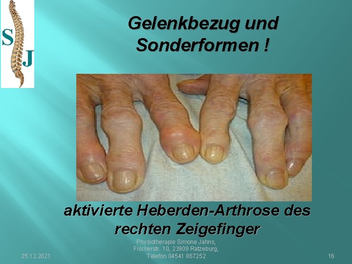 Gelenkbezug und Sonderformen ! aktivierte Heberden-Arthrose des rechten Zeigefinger 25. 12. 2021 Physiotherapie Simone
