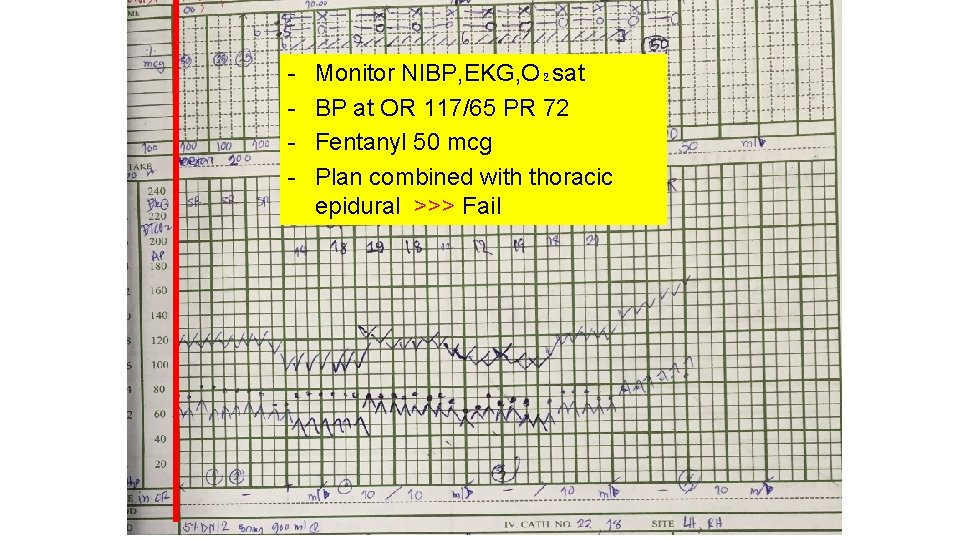 - Monitor NIBP, EKG, O₂sat BP at OR 117/65 PR 72 Fentanyl 50 mcg