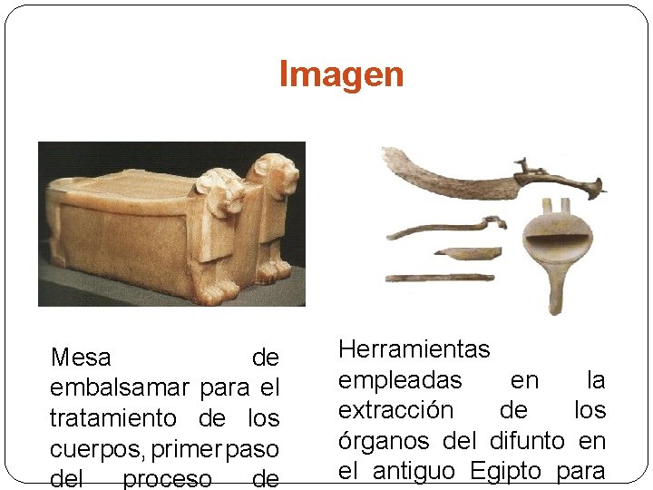 Imagen Mesa de embalsamar para el tratamiento de los cuerpos, primer paso del proceso