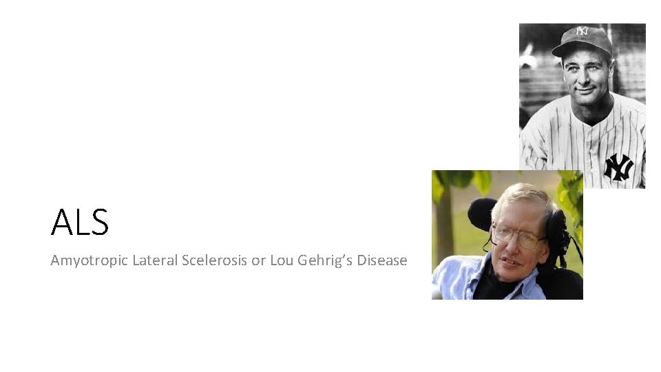 ALS Amyotropic Lateral Scelerosis or Lou Gehrig’s Disease 